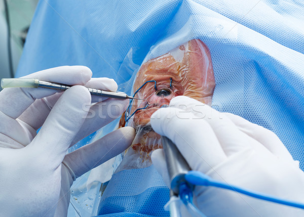 Eye surgery close-up Stock photo © goir