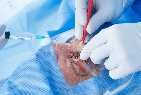Auge Chirurgie Frau öffnen Krankenhaus Arzt Stock foto © goir