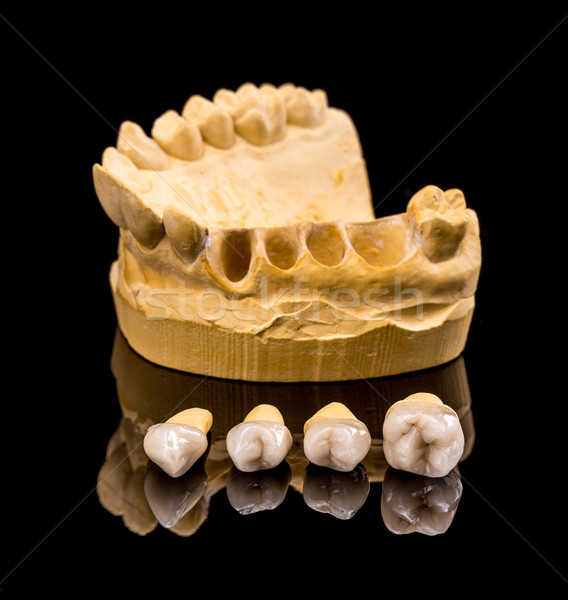 Ceramică dentar gips schema medicină gură Imagine de stoc © grafvision