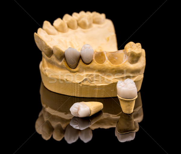 Diş protez tebeşir model siyah yansıma Stok fotoğraf © grafvision