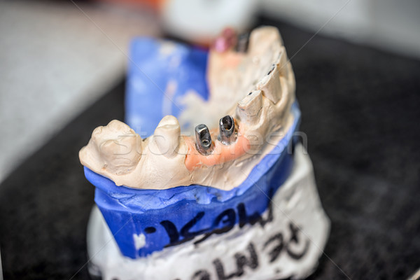 牙科 模型 醫生 技術 醫藥 口 商業照片 © grafvision