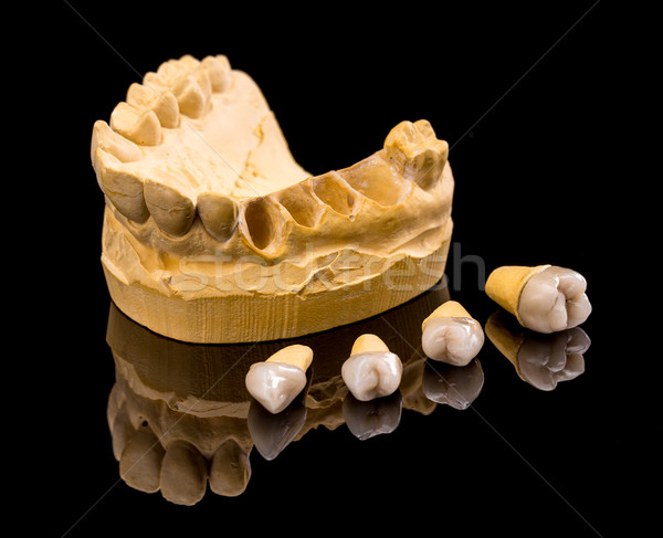 Keramische tandheelkundige gips lay-out geneeskunde mond Stockfoto © grafvision