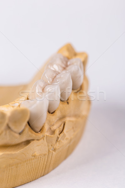 Artificial teeth  Stock photo © grafvision