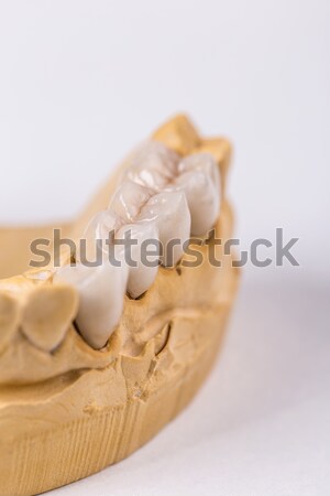 Denture made of ceramics Stock photo © grafvision