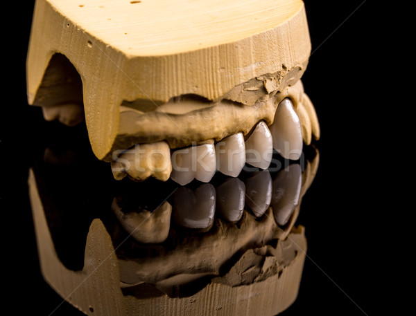Hamis fogak gipsz állkapocs fekete gyógyszer Stock fotó © grafvision