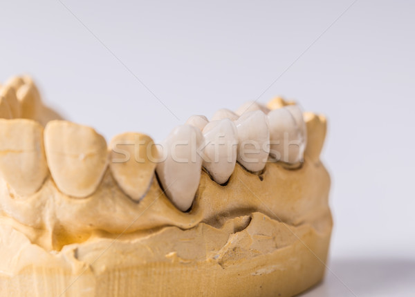 Tandheelkundige prothese krijt model mond tandarts Stockfoto © grafvision