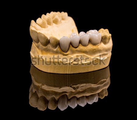 偽 歯 石こう 顎 黒 薬 ストックフォト © grafvision