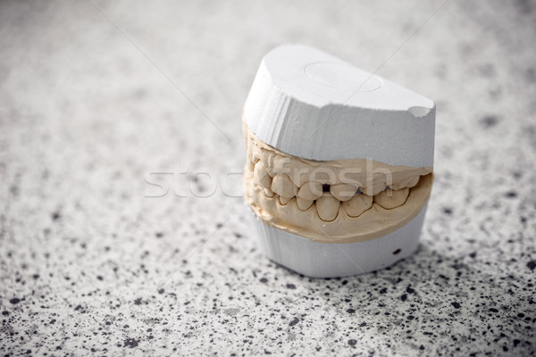 Gips model gipsu zębów Zdjęcia stock © grafvision