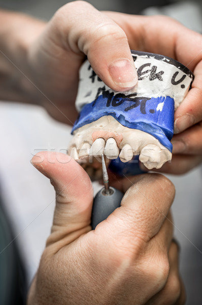 Technicien travail dentier outil technologie médecine [[stock_photo]] © grafvision