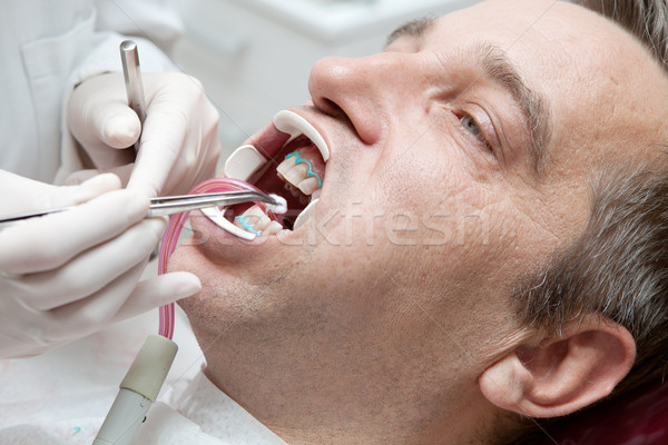 Man during teeth whitening process at the dentist office Stock photo © gsermek