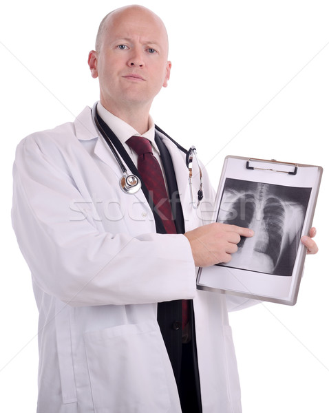 врач Xray сканирование изолированный белый медицинской Сток-фото © hyrons