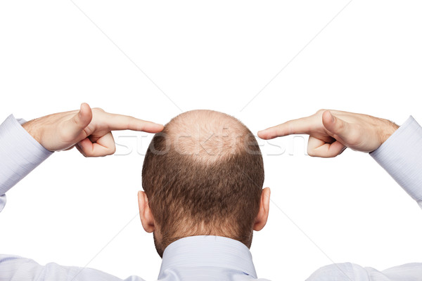 Stock photo: Bald man head