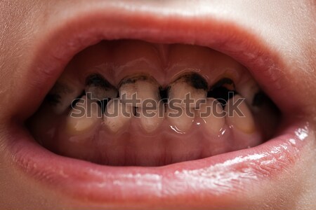 Stok fotoğraf: Dişler · diş · hekimliği · sağlık · insan · hasta · açmak
