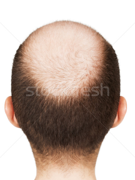 Bald men head Stock photo © ia_64