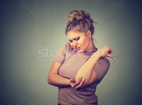Stock photo: Woman with joint inflammation trauma. Female's elbow. Arm pain and injury