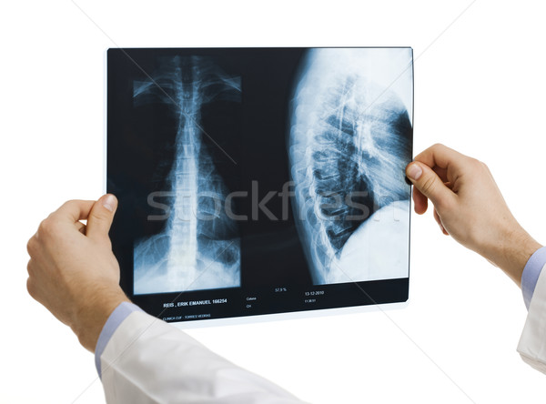 Orvos rx tart izolált fehér férfi Stock fotó © iko