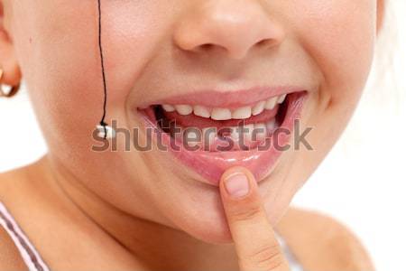 Little girl first tooth missing Stock photo © ilona75
