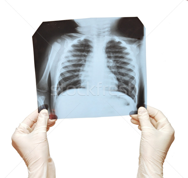 Doctor examining the X-ray over white Stock photo © inxti