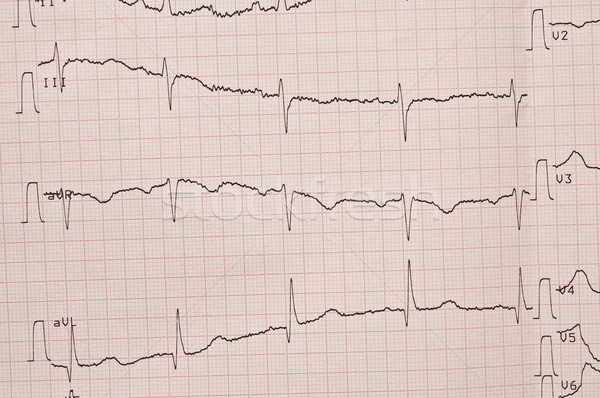 Сток-фото: сердцебиение · графа · диаграммы · здорового