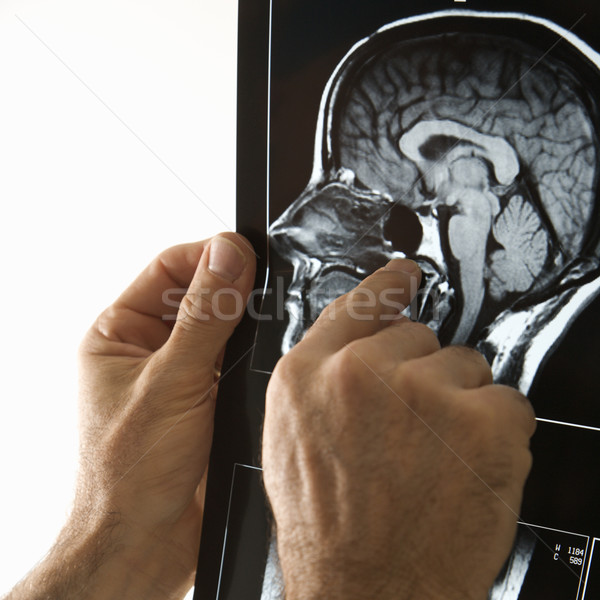 Uomo x ray maschio mani Foto d'archivio © iofoto