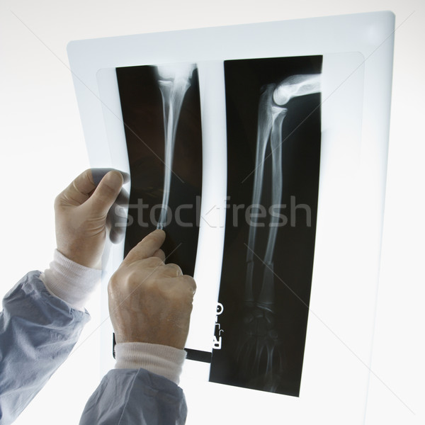 Lekarza rentgenowskiego mężczyzna lekarz wskazując xray Zdjęcia stock © iofoto