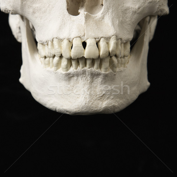 商业照片: 颚· 头骨 · 关闭 · 人的 · 牙齿 · 黑色