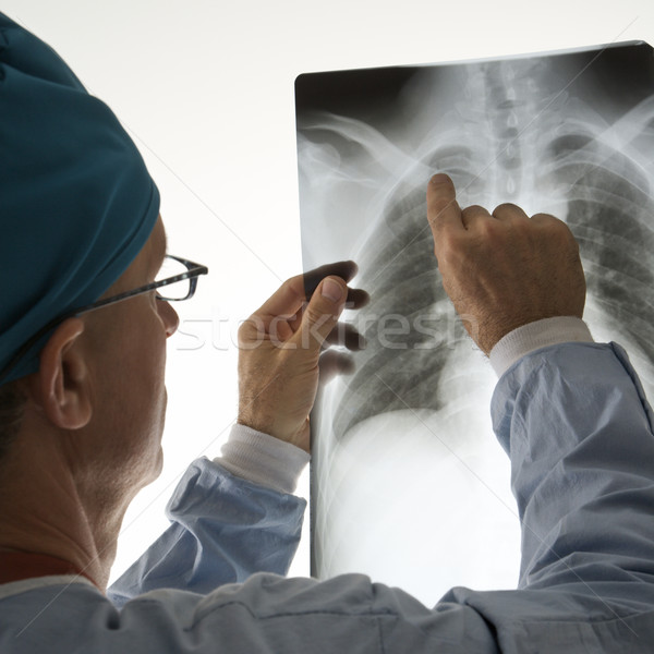 Orvos olvas röntgen kaukázusi férfi orvos mutat Stock fotó © iofoto