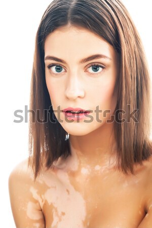 beautiful young brunette woman with vitiligo disease close up isolated on white positive smiling, mo Stock photo © iordani