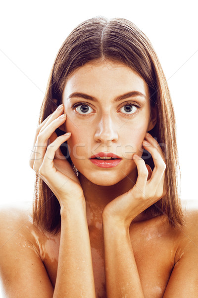 beautiful young brunette woman with vitiligo disease close up isolated on white positive smiling, mo Stock photo © iordani