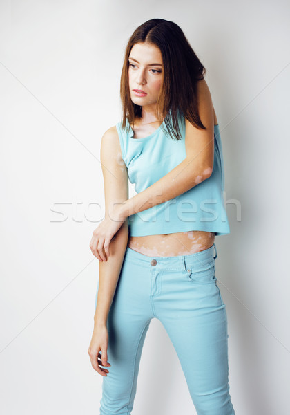 Mooie jonge brunette vrouw ziekte Stockfoto © iordani