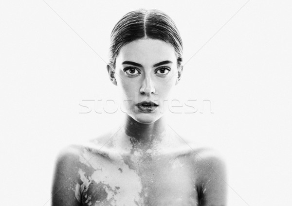 young pretty brunette real modern woman with vitiligo desease close up breast Stock photo © iordani