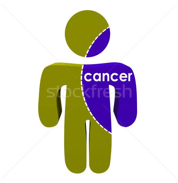 Cancer Word Spreading Human Person Body Illness Disease Stock photo © iqoncept