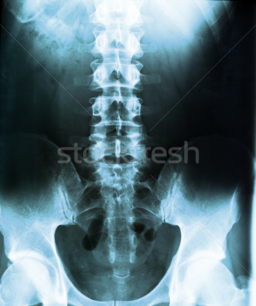 Menschlichen Körper xray Wirbelsäule medizinischen Krankenhaus Stock foto © IvicaNS