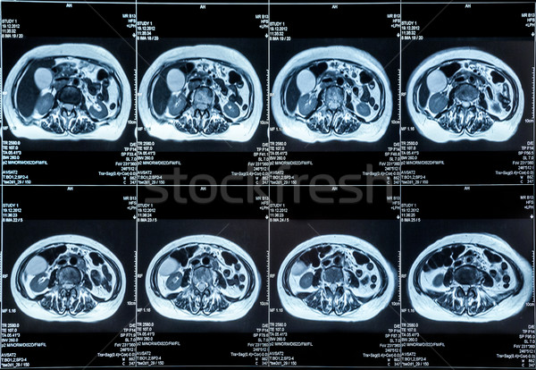 МРТ живот сканирование человека медицинской Сток-фото © IvicaNS