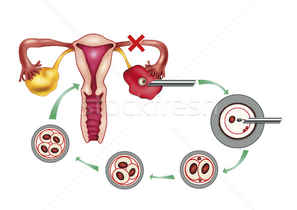 Kunstmatig diagram illustratie geneeskunde wetenschap vagina Stockfoto © izakowski