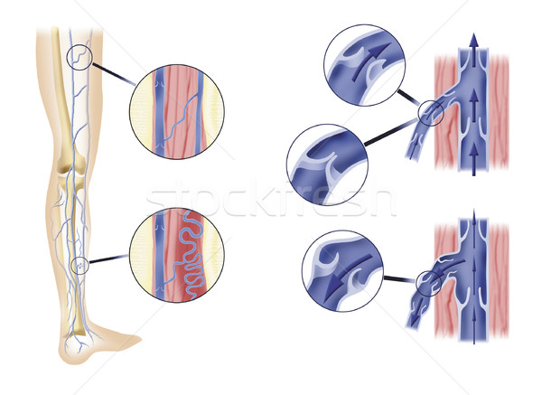 Bein Arterie Diagramm Abteilung Illustration Stock foto © izakowski