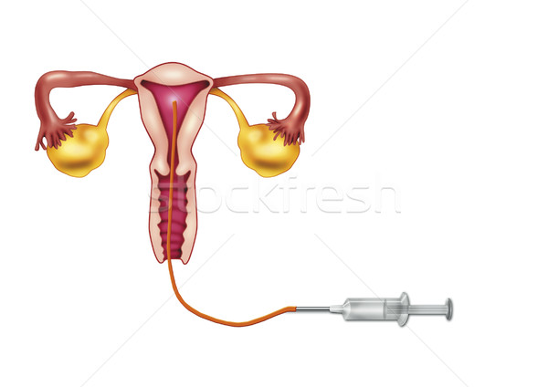 Kunstmatig diagram illustratie geneeskunde wetenschap vagina Stockfoto © izakowski