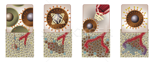 Krebs angreifen Diagramm Illustration Medizin Mikroskop Stock foto © izakowski