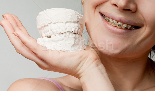 Uśmiech gipsu szczęka model biały kobieta Zdjęcia stock © jagston