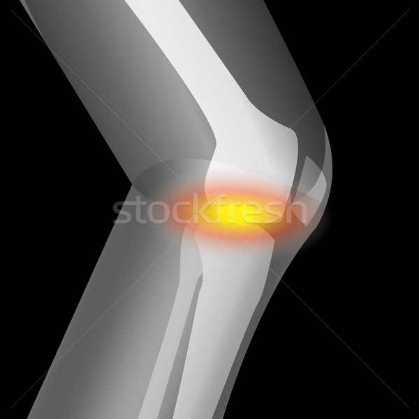 Knie pijn lijden vector ziekenhuis teken Stockfoto © jiaking1