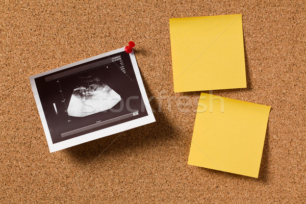Foto stock: Ultra-som · foto · feliz · criança · mãe · grávida