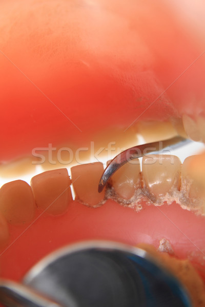 detail of dental problem  Stock photo © jonnysek