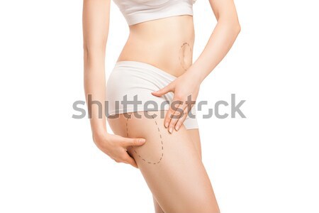 Nő körvonalak plasztikai sebészet test felismerhetetlen lány Stock fotó © julenochek