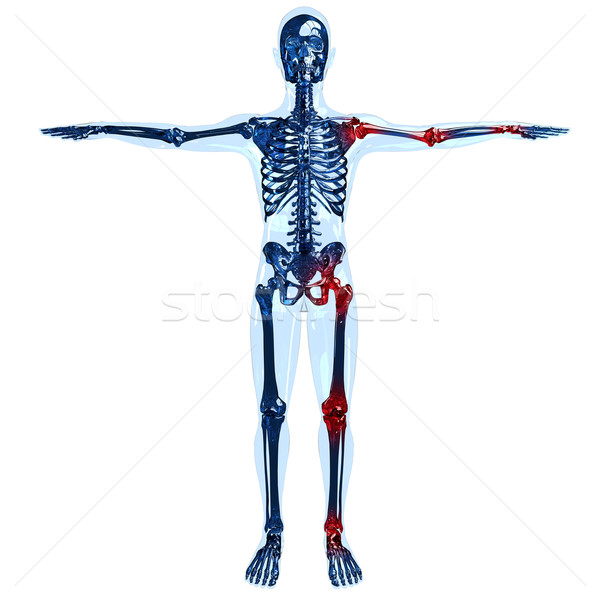 Full human skeleton 3D concept with joint pain on left side Stock photo © kalozzolak