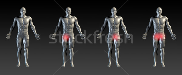 Groin Injury Stock photo © kentoh