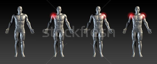 Váll sérülés piros izzik orvosi sportok Stock fotó © kentoh
