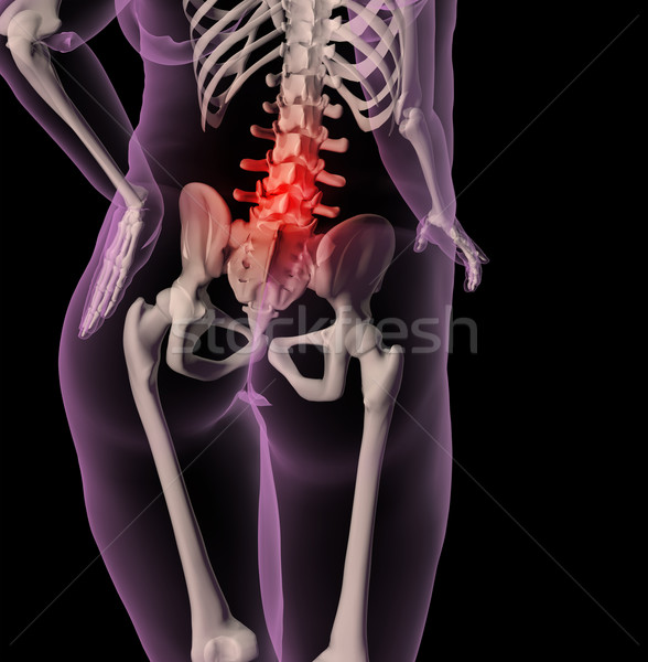 Excesso de peso feminino esqueleto dor nas costas 3d render médico Foto stock © kjpargeter