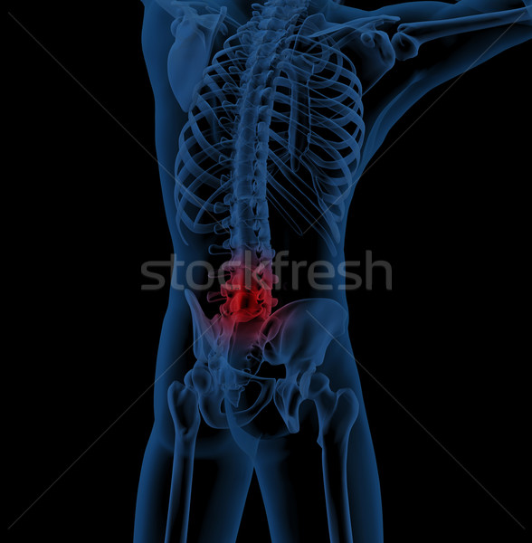 Back pain Stock photo © kjpargeter