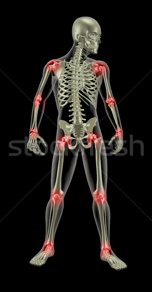 Stock photo: Medical skeleton