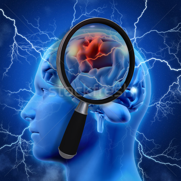 3D medical lupa creier alzheimer Imagine de stoc © kjpargeter